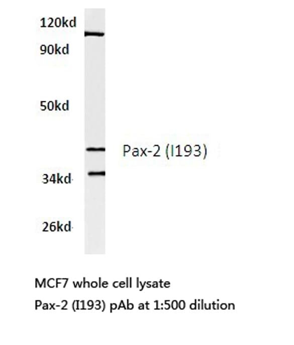 Polyclonal Rabbit anti-Human PAX2 Antibody (Ile193, WB)