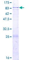 Human ELP3 Protein (Recombinant GST)