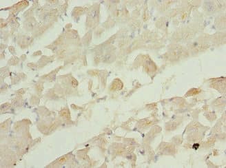 Polyclonal Rabbit anti-Human TC21 / RRAS2 Antibody (IHC, WB)