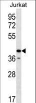 GORASP2 / GRASP55 Antibody (aa185-214)