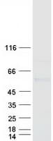 Human GAL3ST4 Protein (Recombinant Myc-DDK (Flag))