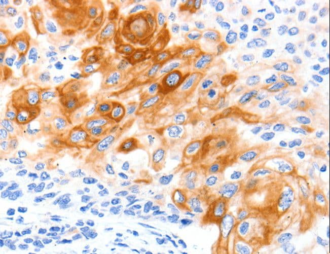 Polyclonal Rabbit anti-Human SLC2A11 / GLUT11 Antibody (IHC)