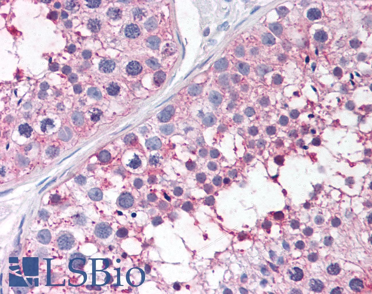 IHC-plus™ Polyclonal Rabbit anti-Human PGES / PTGES Antibody (N-Terminus, IHC)