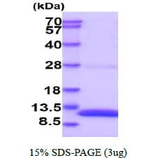 Mouse S100B / S100 Beta Protein (Recombinant His)