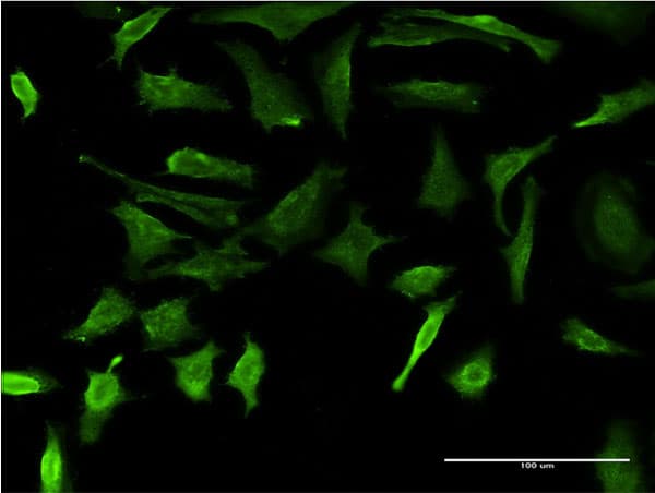 DMP1 Antibody (clone 1D4)