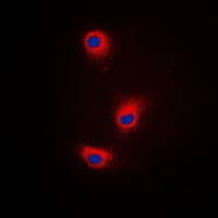 DCT / Dopachrome Tautomerase Antibody (Internal)