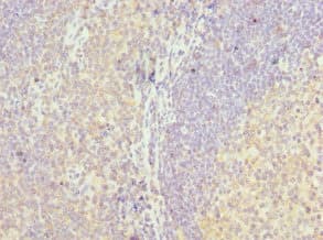 Polyclonal Rabbit anti-Human MD-1 / LY86 Antibody (IHC)