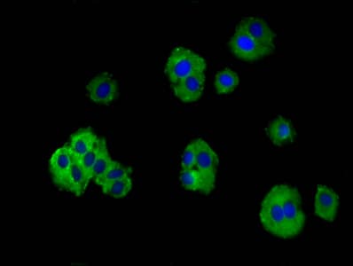 TRPV3 Antibody