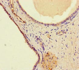 WDFY4 Antibody