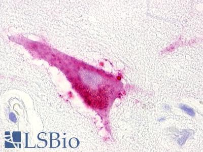 PathPlus™ LPAR5 / GPR92 Antibody (Cytoplasmic Domain)