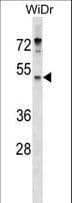 ENPP4 Antibody (aa171-200)