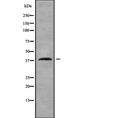 OR2T4 Antibody