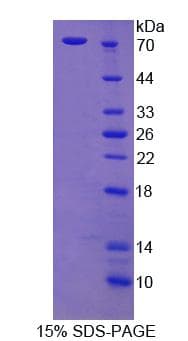 Rat CTTN / Cortactin Protein (Recombinant His-T7)