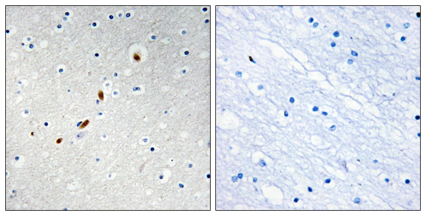 ZNF596 Antibody