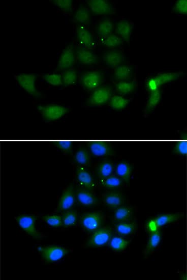 Tyrosine Aminotransferase Antibody