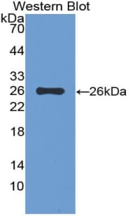 TIGIT Antibody (aa28-227, Cy3)