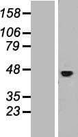 IL11RA Protein (Over-Expression Lysate Myc-DDK (Flag))