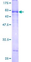 Human SPOCK2 Protein (Recombinant GST)