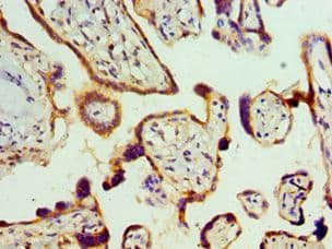 RBX1 / ROC1 Antibody (aa1-108)