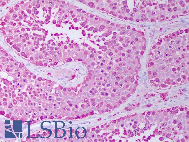 IHC-plus™ HSP90 / Heat Shock Protein 90 Antibody (clone 4F3.E8)