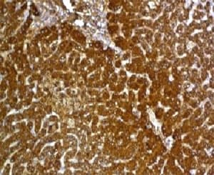 GPC3 / Glypican 3 Antibody (clone GPC3/863, Ready-to-Use)
