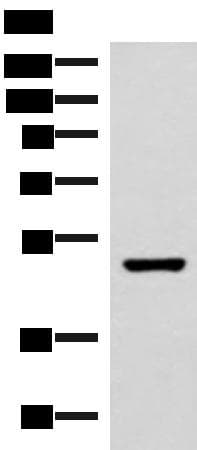 IP6K2 Antibody