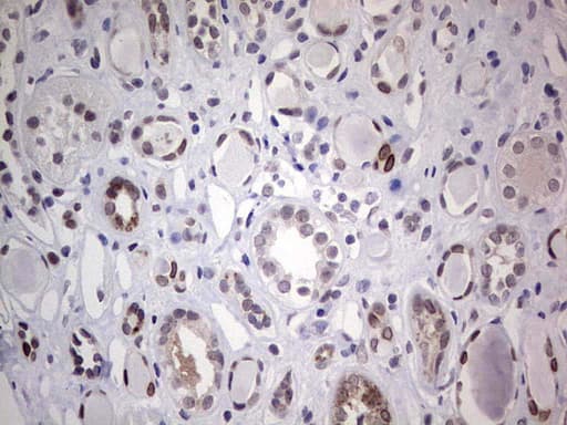 HDAC9 Antibody (aa181-460, clone OTI5B8)