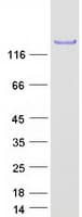 Human EPS15 Protein (Recombinant Myc-DDK (Flag))