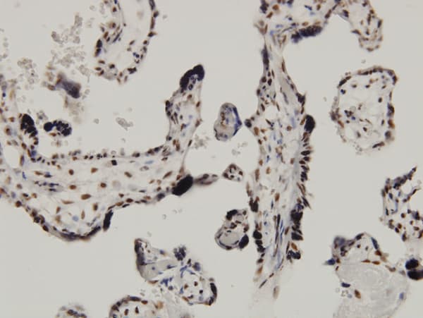 CDKN2AIP Antibody (clone 1A6)