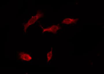 Polyclonal Rabbit anti-Human OR4X1 Antibody (IF, WB)
