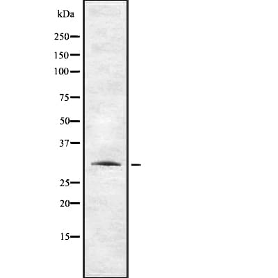 Putative Taste receptor Type 2 member 12 (TAS2R12) Antibody