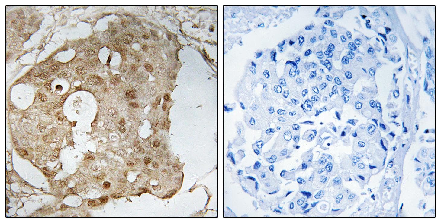 Polyclonal Rabbit anti-Human TP53 / p53 Antibody (phospho-Ser366, IHC, WB)