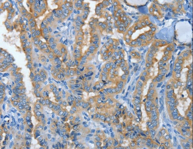 Polyclonal Rabbit anti-Human MUC15 Antibody (IHC)