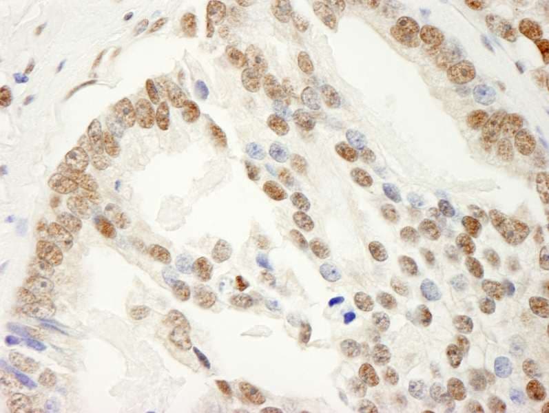 KHDRBS1 / SAM68 Antibody (aa1-50)