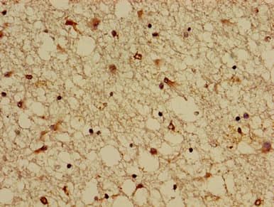 Polyclonal Rabbit anti-Human KCNIP3 / Dream / Calsenilin Antibody (IHC, IF, WB)