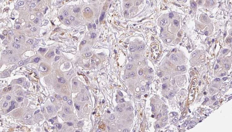 Polyclonal Rabbit anti-Human OR2A12 Antibody (IHC, WB)