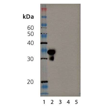 SIRT5 / Sirtuin 5 Antibody