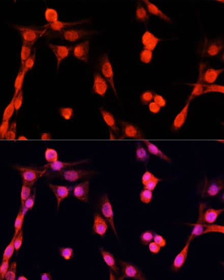 EGFR Antibody