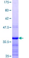 Human WT1 / Wilms Tumor 1 Protein (Recombinant GST, N-terminus)
