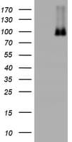 NBN / Nibrin Antibody (clone OTI3A9)
