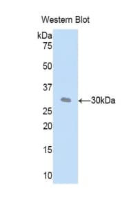 CFD / Factor D / Adipsin Antibody (aa1-259)