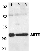 SEPT4 / Septin 4 Antibody (aa3-14)
