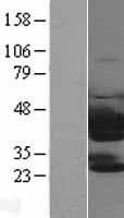 TWF1 / PTK9 Protein (Over-Expression Lysate Myc-DDK (Flag))
