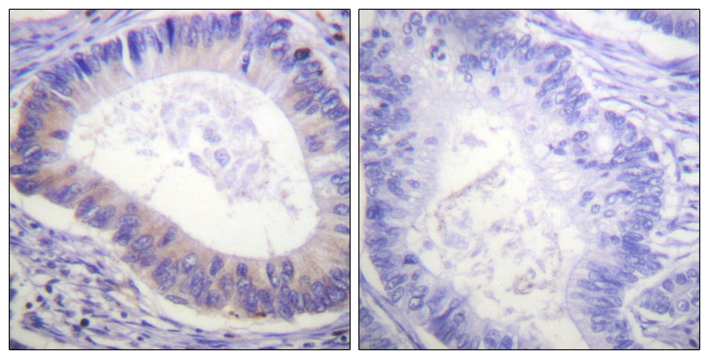 PDE4D Antibody (phospho-Ser190/Ser53)