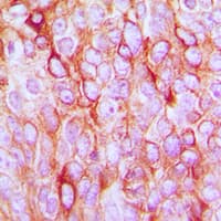 TGFA / TGF Alpha Antibody (C-Terminus)
