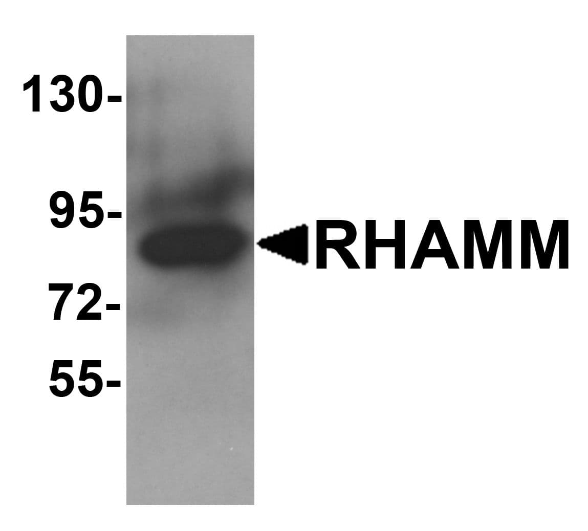 IHC-plus™ HMMR / CD168 / RHAMM Antibody