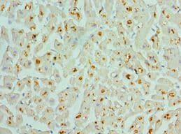 ASAH1 / Acid Ceramidase Antibody (aa146-395)