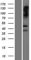 SAMD8 Protein (Over-Expression Lysate Myc-DDK (Flag))