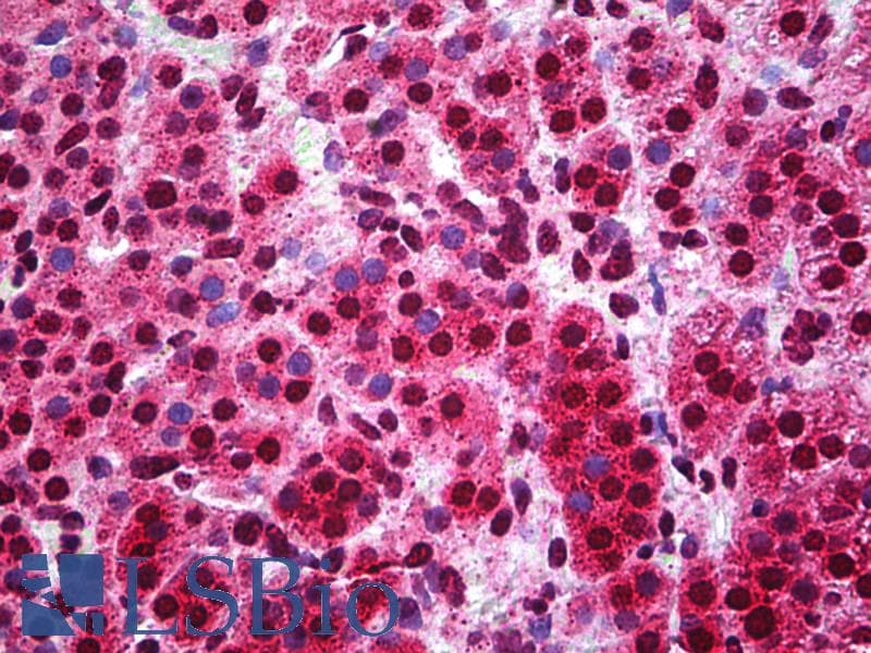 IHC-plus™ Polyclonal Rabbit anti-Human Capicua / CIC Antibody (aa1150-1200, IHC, WB)