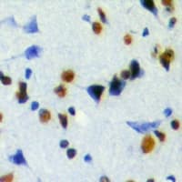 JMJD6 / PSR Antibody